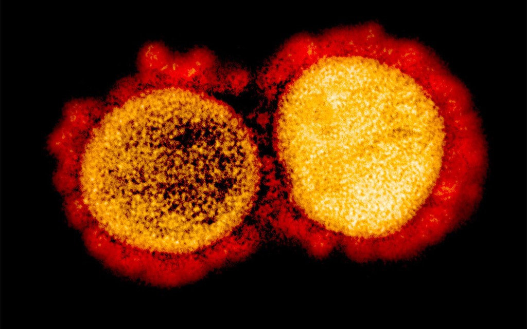 Image: This transmission electron micrograph shows SARS-CoV-2 virus particles isolated from a patient suffering from COVID-19 (Photo courtesy of NIAID).