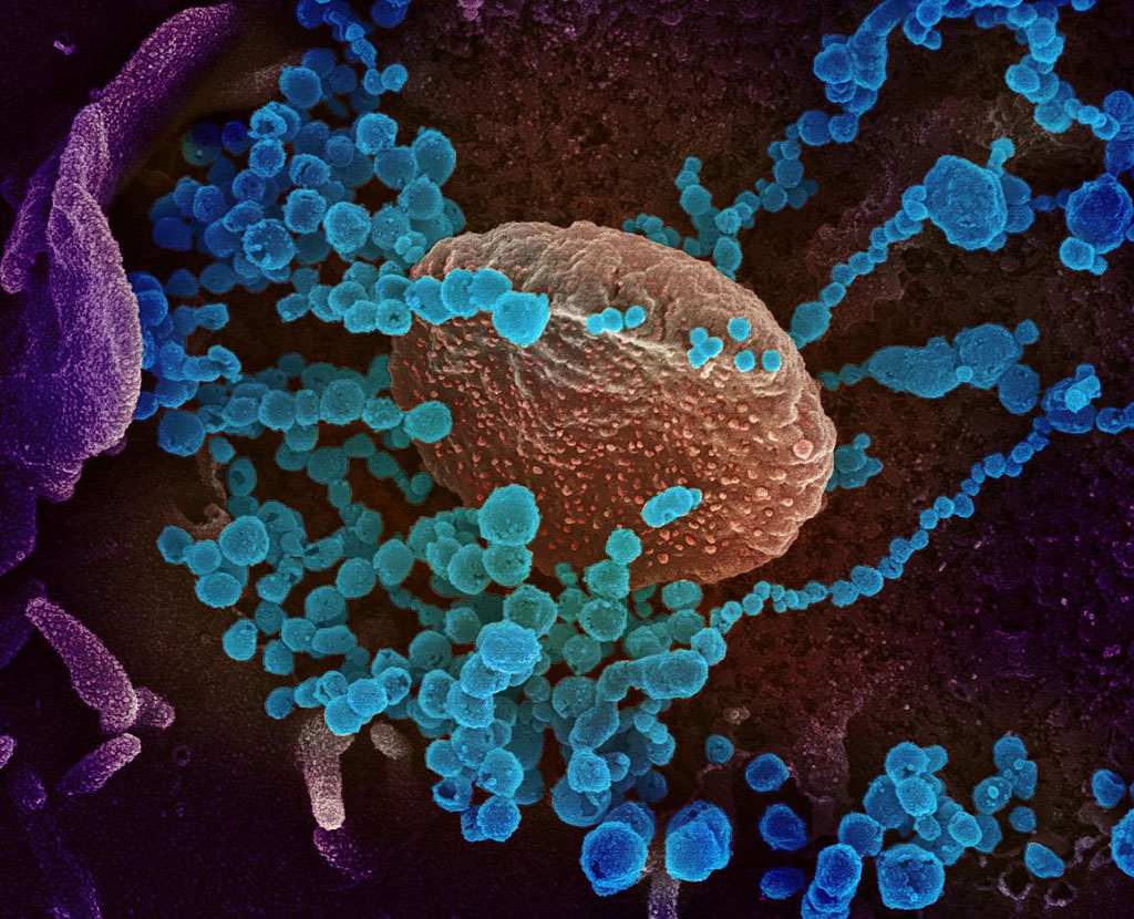 Image: This scanning electron microscope image shows SARS-CoV-2 (round blue objects) emerging from the surface of cells cultured in the lab (Photo courtesy of NIAID)