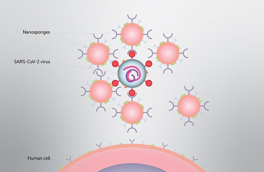 Image: Nanosponges attacking and neutralizing the SARS-COV-2 virus (Photo courtesy of UC San Diego)