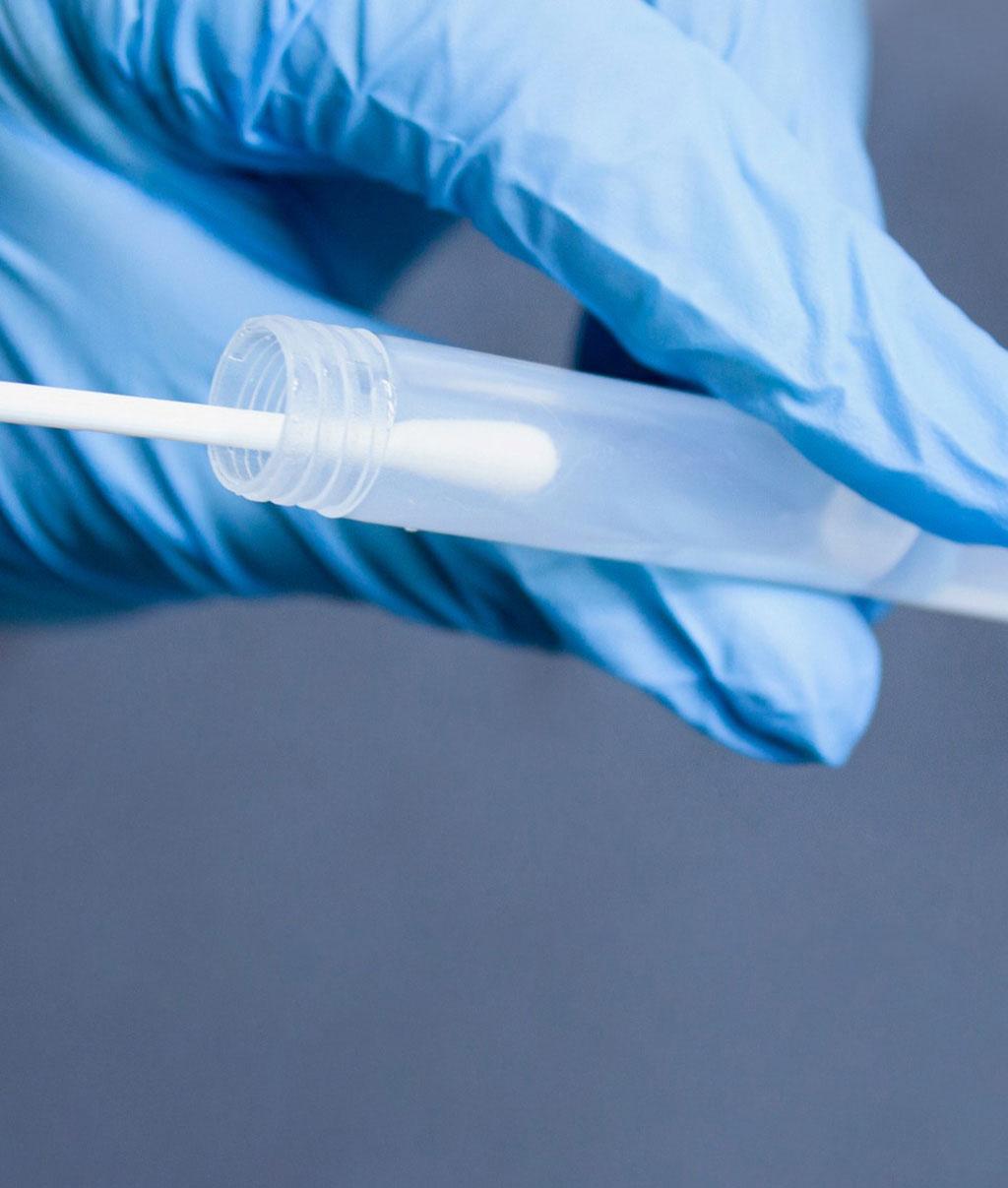 Image: EKF Diagnostics Launches Novel Molecular Transport Media for Dual COVID-19 and Influenza Sampling (Photo courtesy of EKF Diagnostics) Image: EKF Diagnostics Launches Novel Molecular Transport Media for Dual COVID-19 and Influenza Sampling (Photo courtesy of EKF Diagnostics)