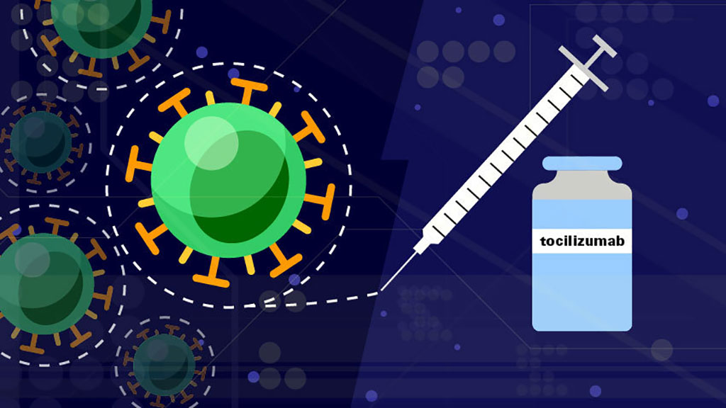 Image: Tocilizumab Calms Cytokine Storm and Lowers Risk of Dying by 45% in COVID-19 Patients on Ventilators (Photo courtesy of Stephanie King)