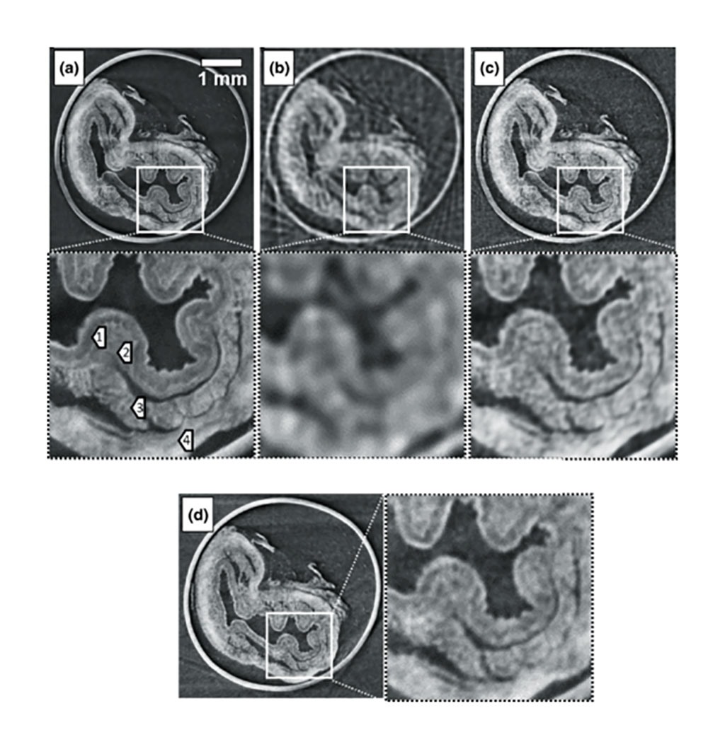 Image: CT images of a rabbit esophagus, acquired with (a) dithering, (b) rotation (c) cycloidal CT sampling, and (d) cycloidal sampling in continuous mode. (Photo courtesy of UCL) Image: CT images of a rabbit esophagus, acquired with (a) dithering, (b) rotation (c) cycloidal CT sampling, and (d) cycloidal sampling in continuous mode. (Photo courtesy of UCL)