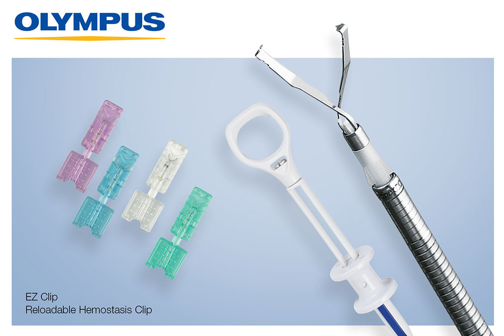 Image: The EZ Clip endotherapy device and clips (Photo courtesy of Olympus)