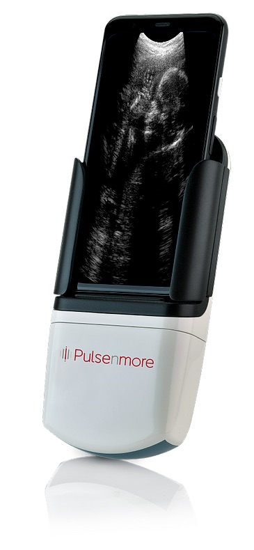 The PulseNmore dockable ultrasound solution (Photo courtesy of PulseNmore)