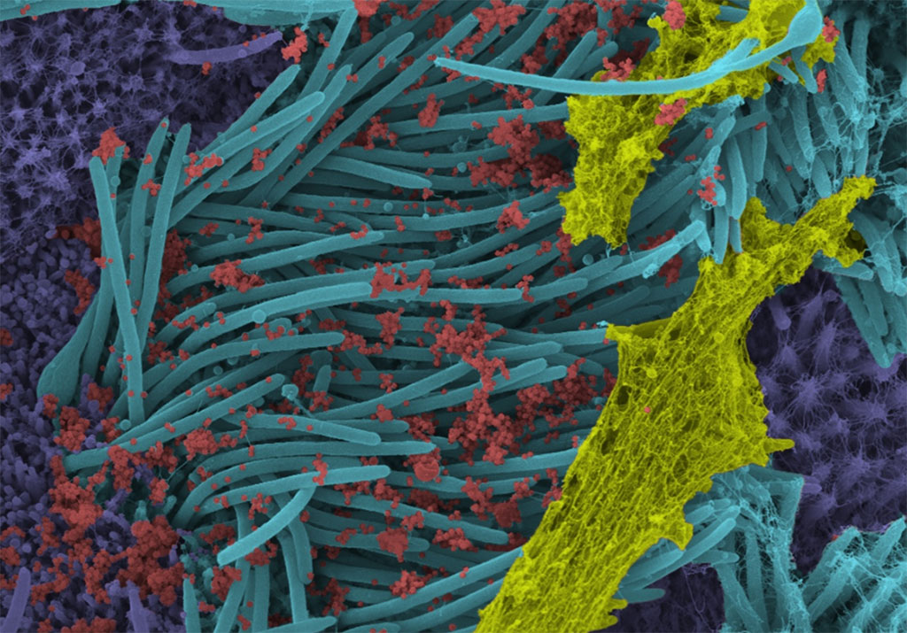 Image: SARS-CoV-2 virions (red). (Photo courtesy of UNC School of Medicine)