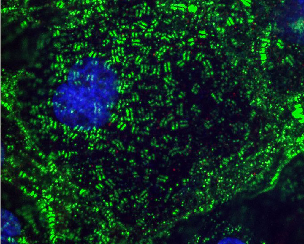 Image: A study by scientists explains how SARS-CoV-2 inflicts damage on heart cells (Photo courtesy of Gladstone Institutes)