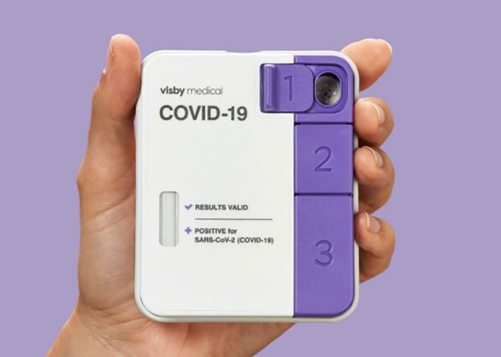 Image: New Portable PCR COVID-19 Test Kit from Visby Medical Secures FDA Emergency Use Authorization (Photo courtesy of Visby Medical)