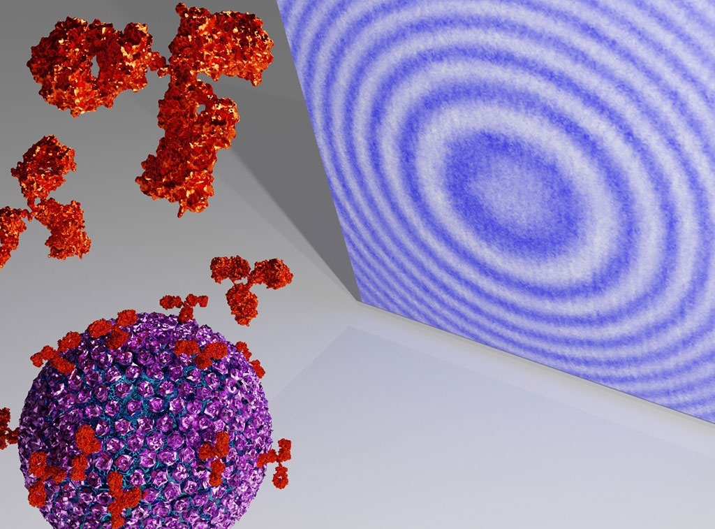 Image: A rendering of holographic microscopy of a test bead binding antibodies (Photo courtesy of NYU`s David Grier)