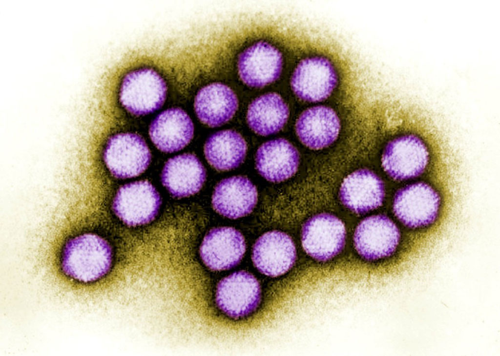 Image: Unique COVID-19 Vaccine Uses Modified Bovine Adenovirus to Provide Significantly Higher Levels of Immunity (B) (Photo courtesy of CDC)
