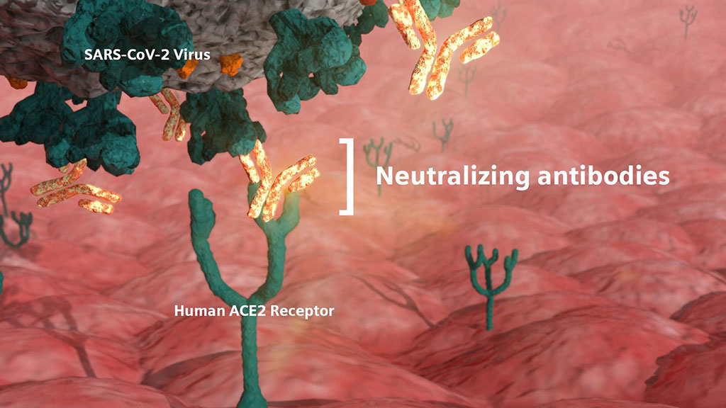 Image: Neutralizing antibodies are critical in the fight against COVID-19 because they defend cells from infection by the virus (Photo courtesy of Siemens Healthineers)