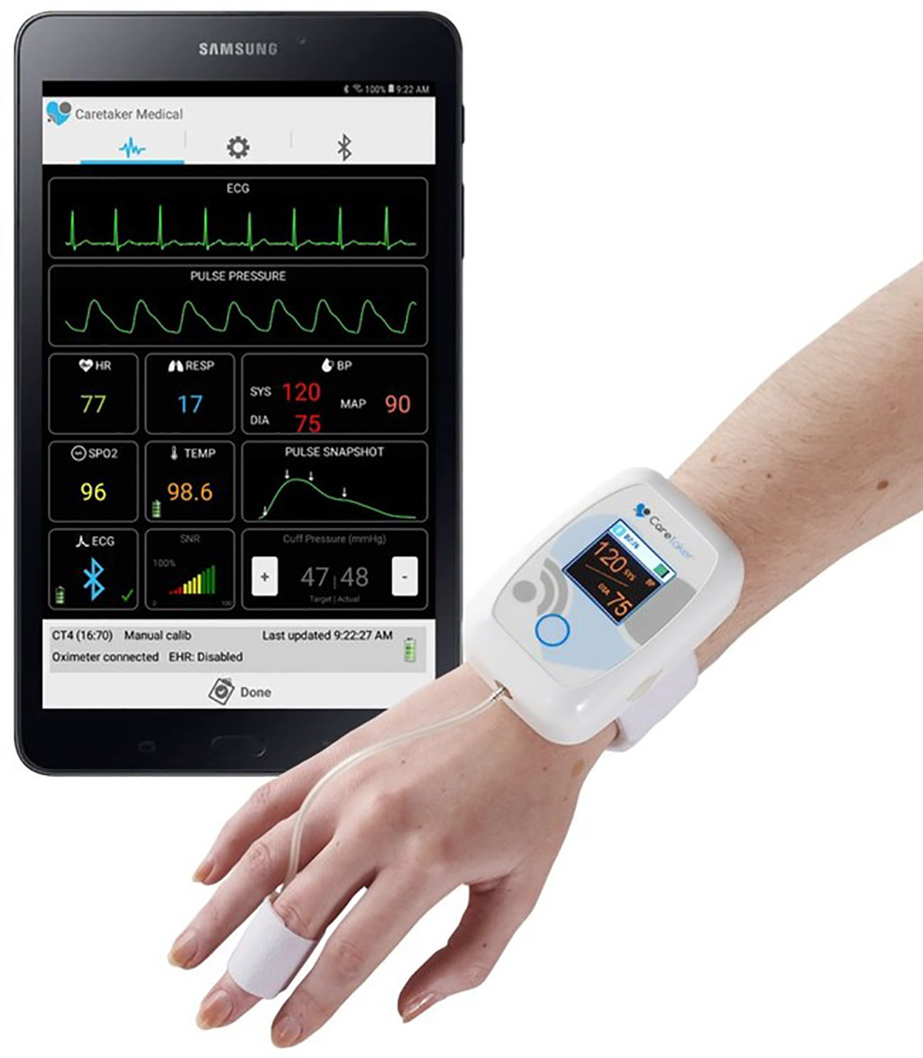 Image: Caretaker Wireless Patient Monitor (Photo courtesy of Caretaker Medical)