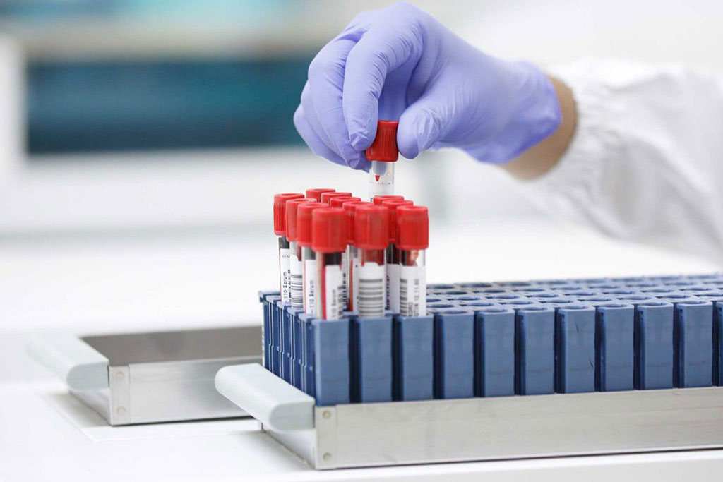 Roche collaborates with Moderna to include Covid-19 test in vaccine trials