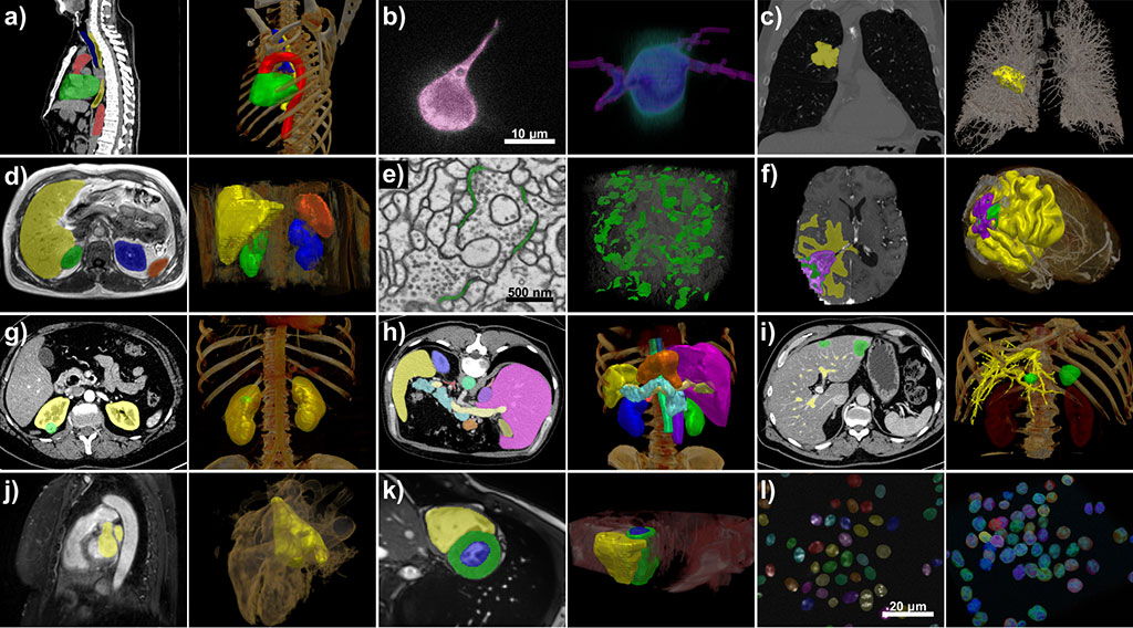 Image: nnU-Net handles a broad variety of datasets and target image properties (Photo courtesy of Isensee et al. / Nature Methods)