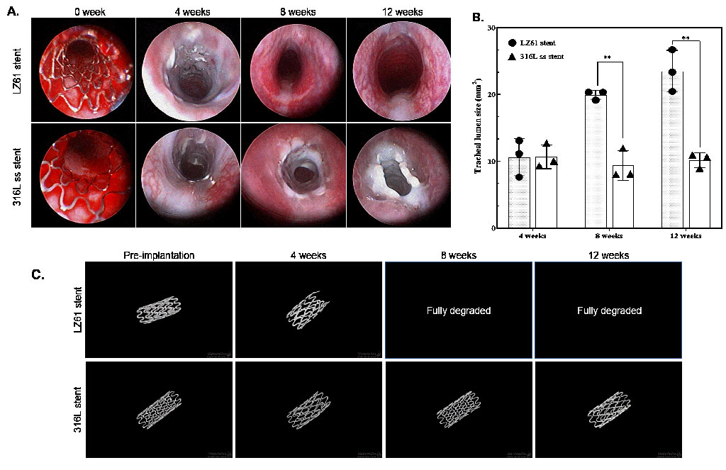 Image: Endoscopic images of the stented airway right after implantation, and after 4, 8 and 12 weeks of implantation (Photo courtesy of Nature Communications Biology)