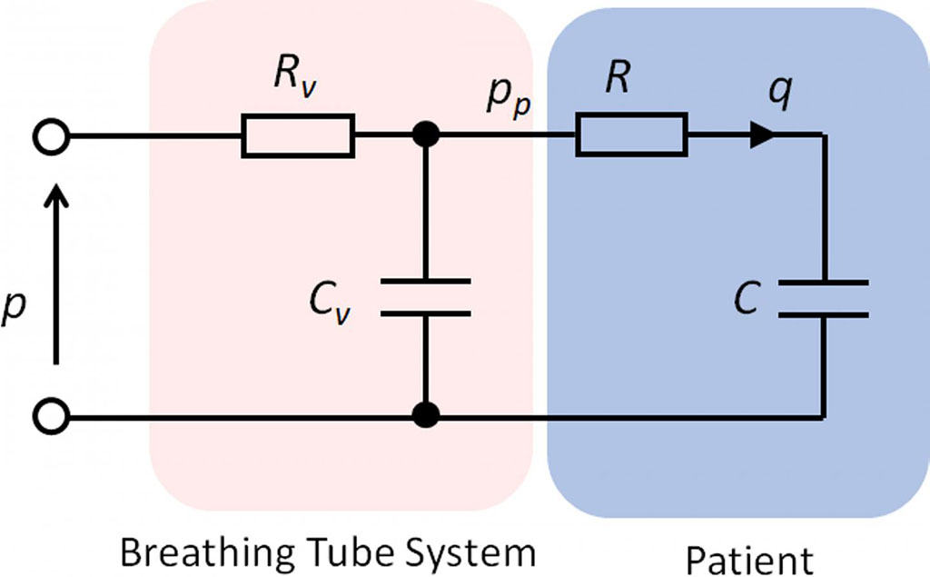 Image: Simple RC network model of ventilator system and patient, with linear resistance (Rv) and compliance (Cv) for the ventilator tubing system, and linear resistance (R) and compliance (C) for the patient (Photo courtesy of University of Bath)