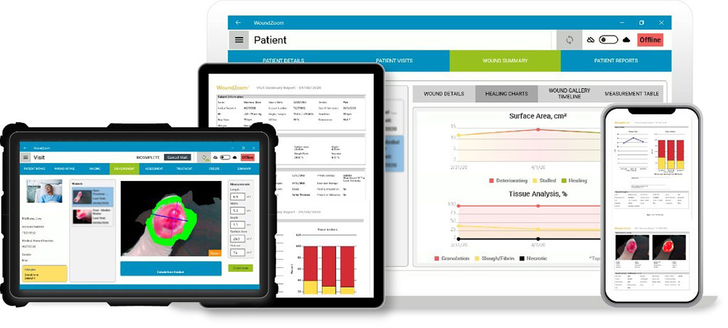 Image: The WoundZoom software platform and dashboards (Photo courtesy of Perceptive Solutions)