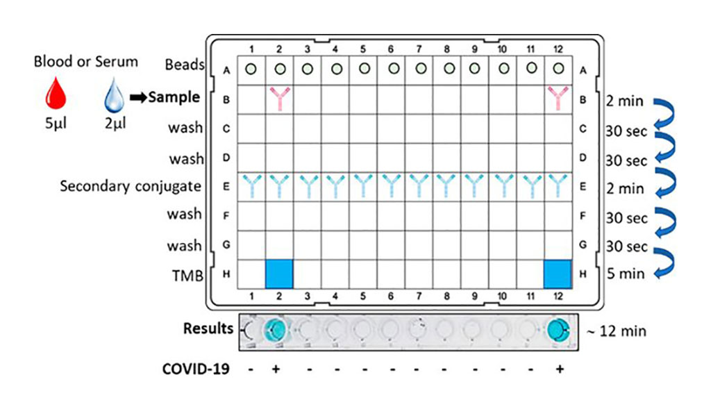 Image: New Rapid COVID-19 Test Beats ELISA Method in Identifying SARS-CoV-2 Antibodies in Blood within Just 12 Minutes (Photo courtesy of American Chemical Society)