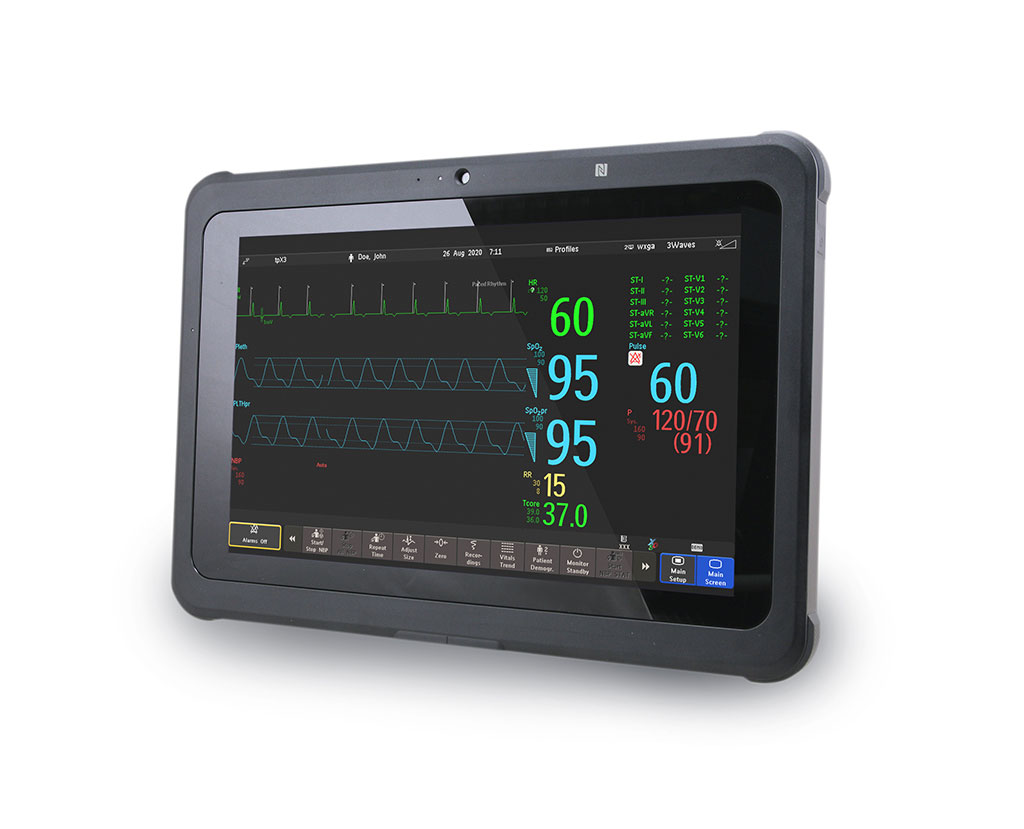 Image: The Philips Medical Tablet (Photo courtesy of Philips)