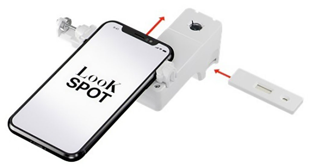 Image: LooK SPOT App (Photo courtesy of AETOSWire)