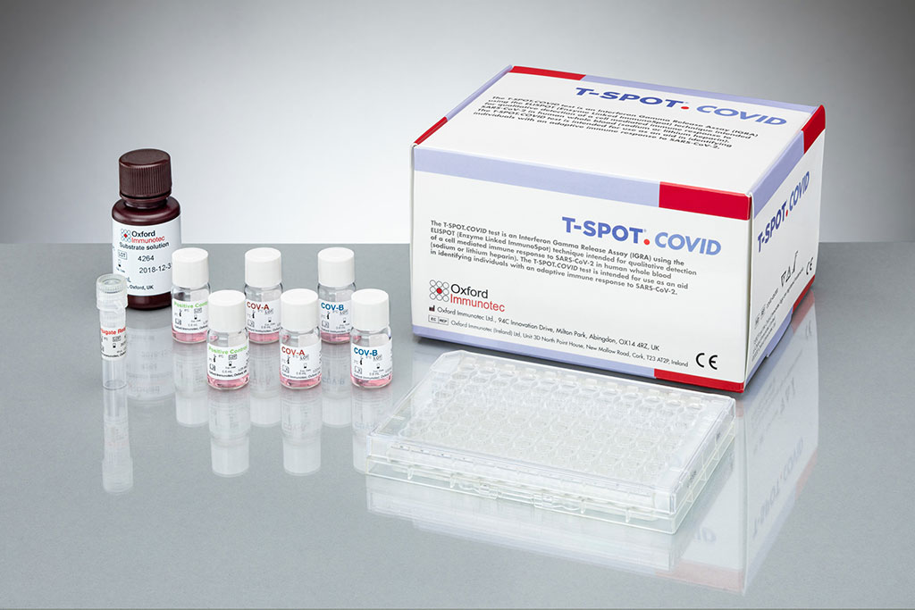 Image: T-SPOT.COVID test (Photo courtesy of Oxford Immunotec Global PLC)