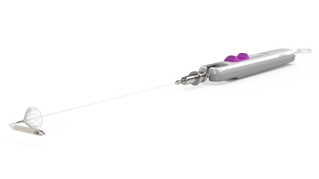 Image: The Viola clampless proximal anastomosis system (Photo courtesy of VGS)