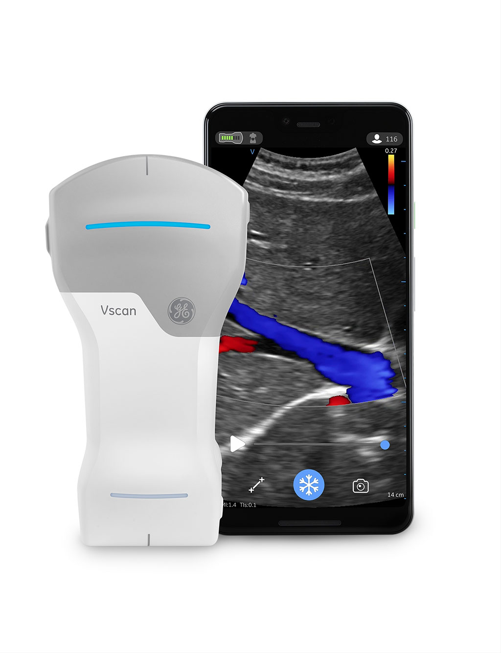 Image: Vscan Air (Photo courtesy of Business Wire)