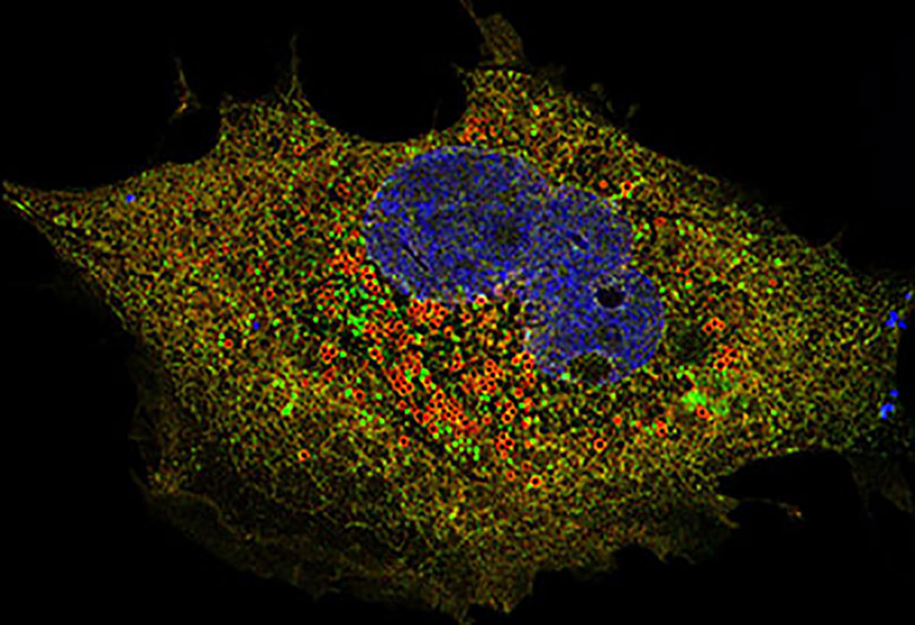 Image: SARS-COV-2 Orf6 protein (red) in a mammalian cell (Photo courtesy of Dr. Zhe Han)