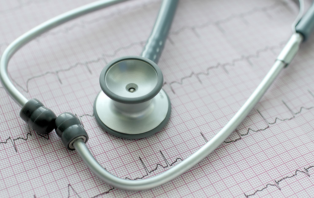 Image: ECG data can be analyzed to predict future AF risk (Photo courtesy of Getty Images)