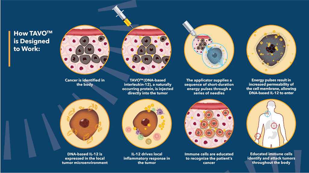 Image: TAVO and electroporation kill cancer cells (Photo courtesy of OMS)