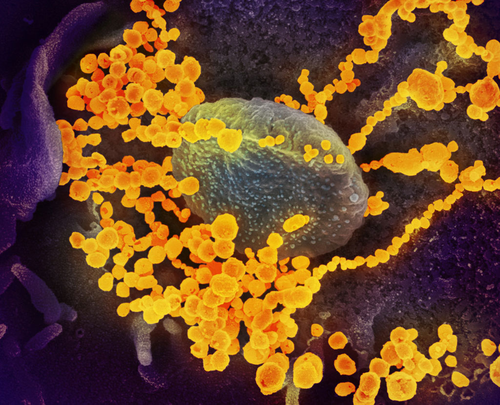 Image: A scanning electron microscope image showing SARS-CoV-2 (round gold objects), the virus that causes COVID-19, emerging from the surface of cells cultured in the lab (Photo courtesy of NIAID)