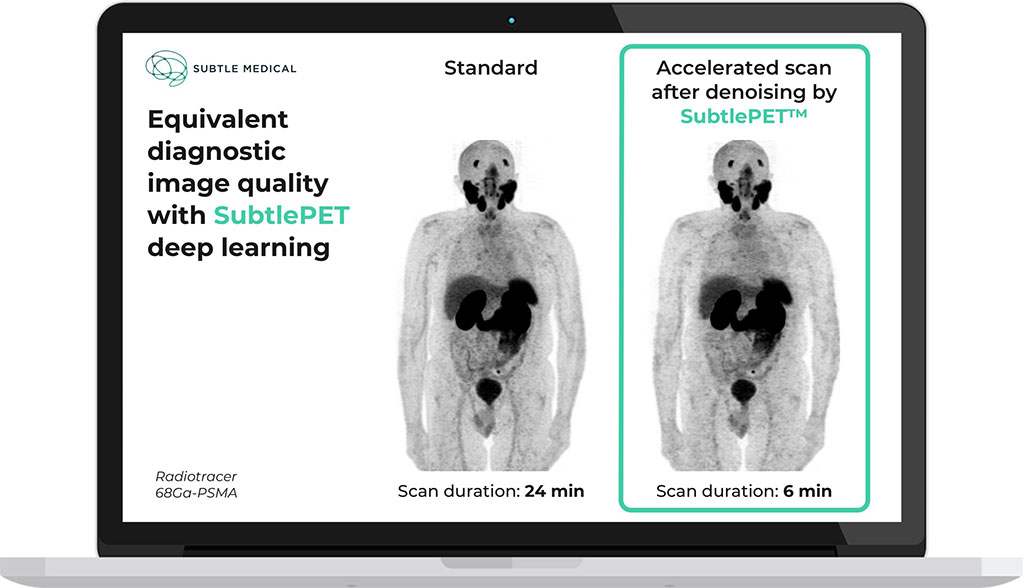 Image: Equivalent diagnostic image quality of SubtlePET software (Photo courtesy of Subtle Medical) Image: Equivalent diagnostic image quality of SubtlePET software (Photo courtesy of Subtle Medical)