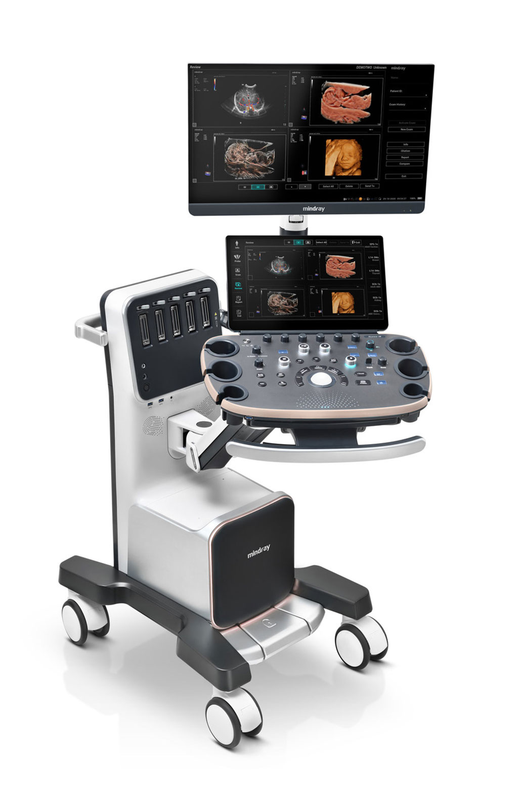 Image: The Nuewa I9 OB/GYN ultrasound system (Photo courtesy of Mindray) Image: The Nuewa I9 OB/GYN ultrasound system (Photo courtesy of Mindray)
