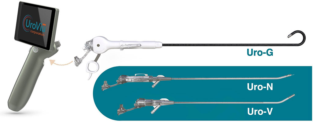 Image: The Uro-G Completes the UroViu suite of disposable cystoscope cannulas (Photo courtesy of UroViu)