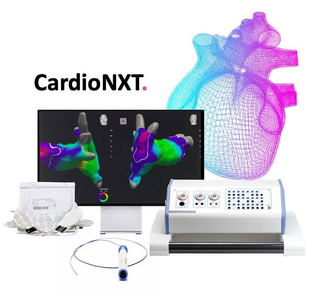 Image: The CardioNXT system (Photo courtesy of CardioNXT)
