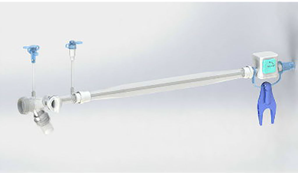 Image: Shaoxing Undis’ Closed Suction Catheter (Photo courtesy of Shaoxing Undis Medical Technology Co., Ltd.)