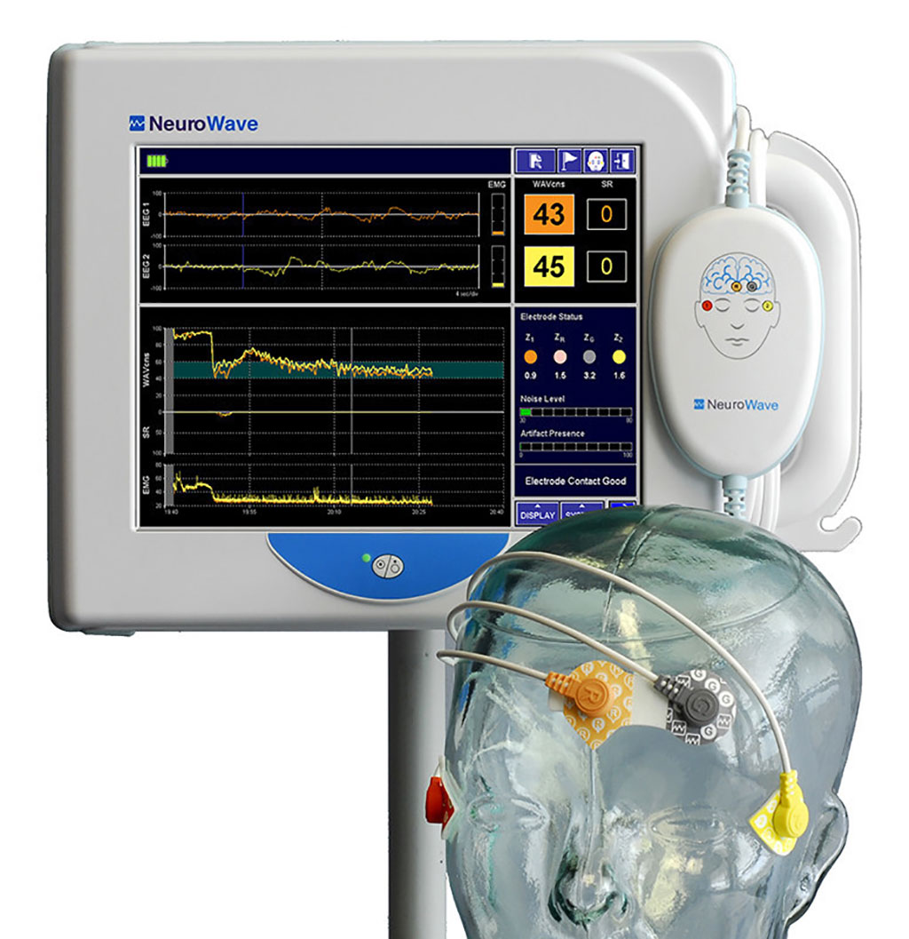 Image: The NeuroSense NS-901 monitor (Photo courtesy of NeuroWave Systems)