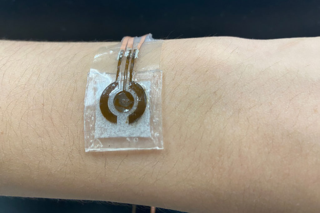 Image: Wearable, Non-invasive Glucose Sensor (Photo courtesy of Jia Zhu)