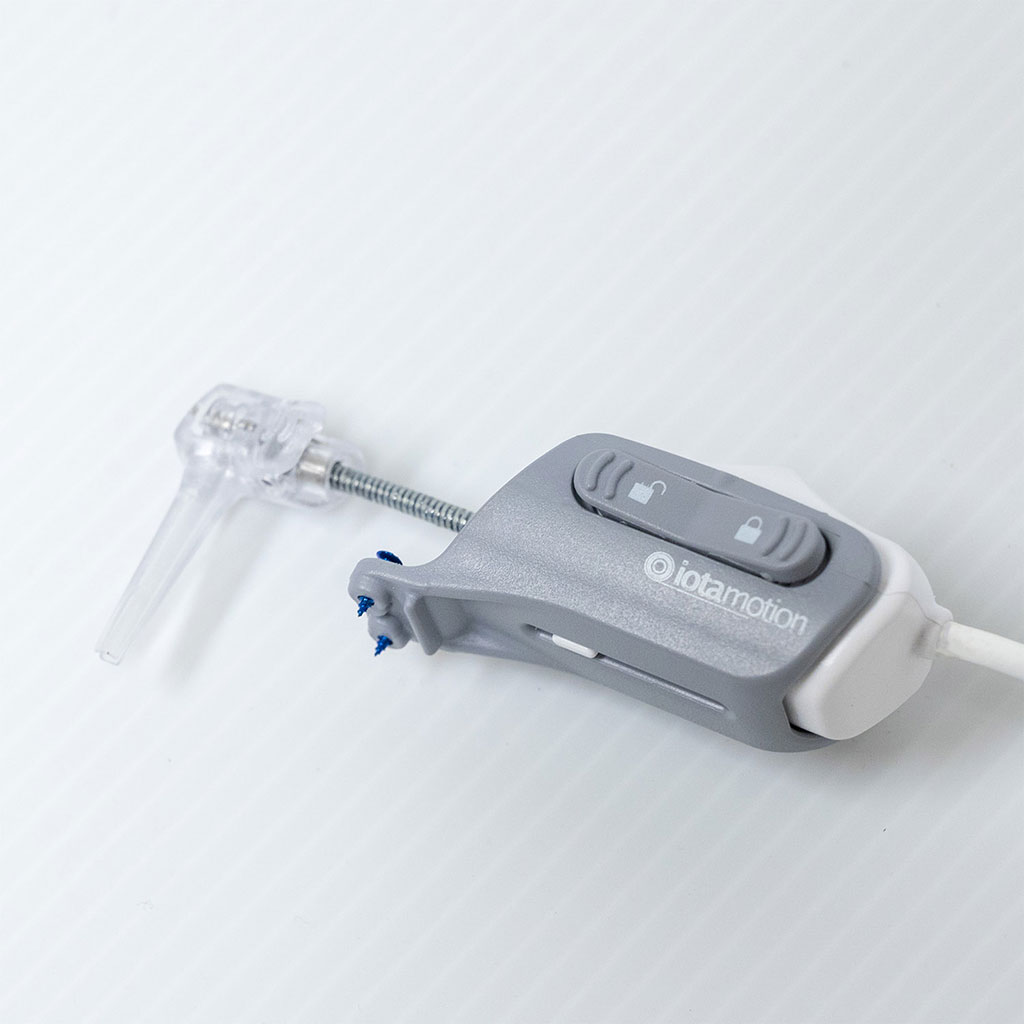 Image: The iotaSOFT cochlear implant insertion system (Photo courtesy of iotaMotion)