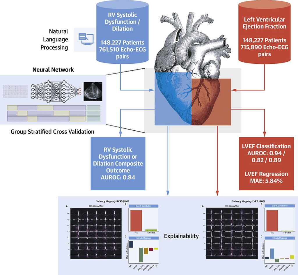 Image: An AI-based tool can identify heart failure from ECG (Photo courtesy of MSSM/ JACC)