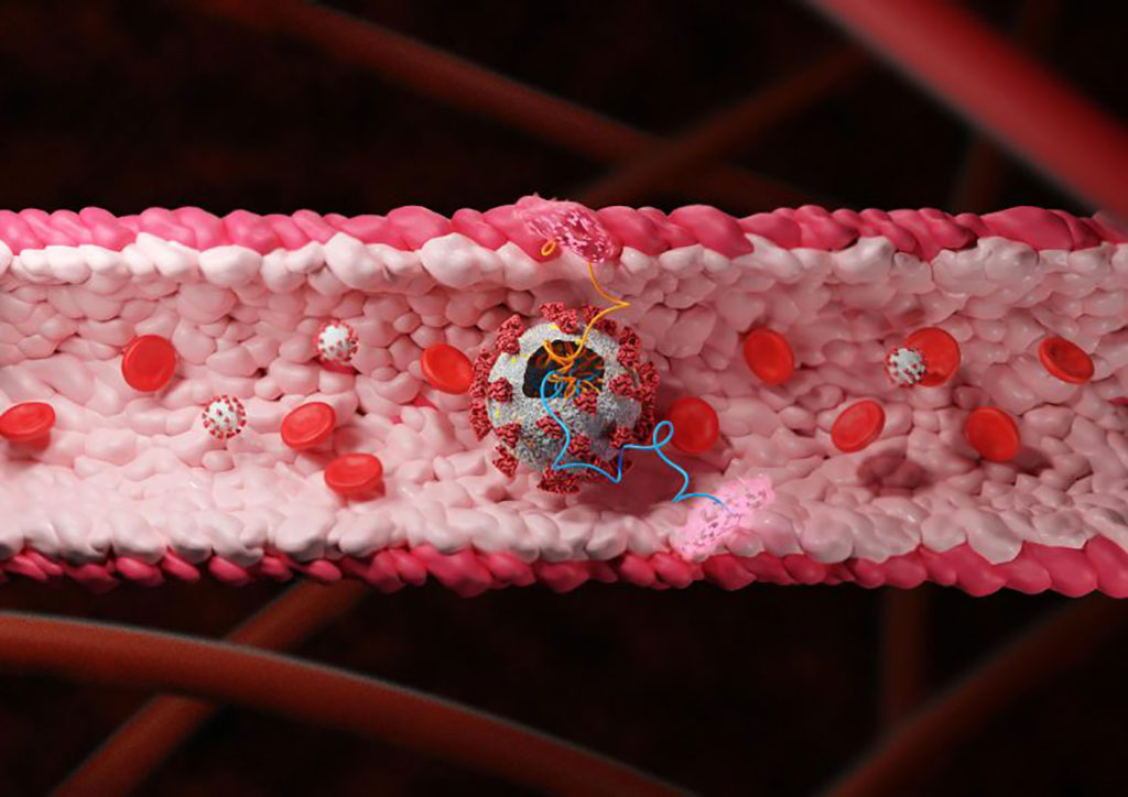 Image: Illustration of Coronavirus in blood vessel (Photo courtesy of Tel Aviv University)