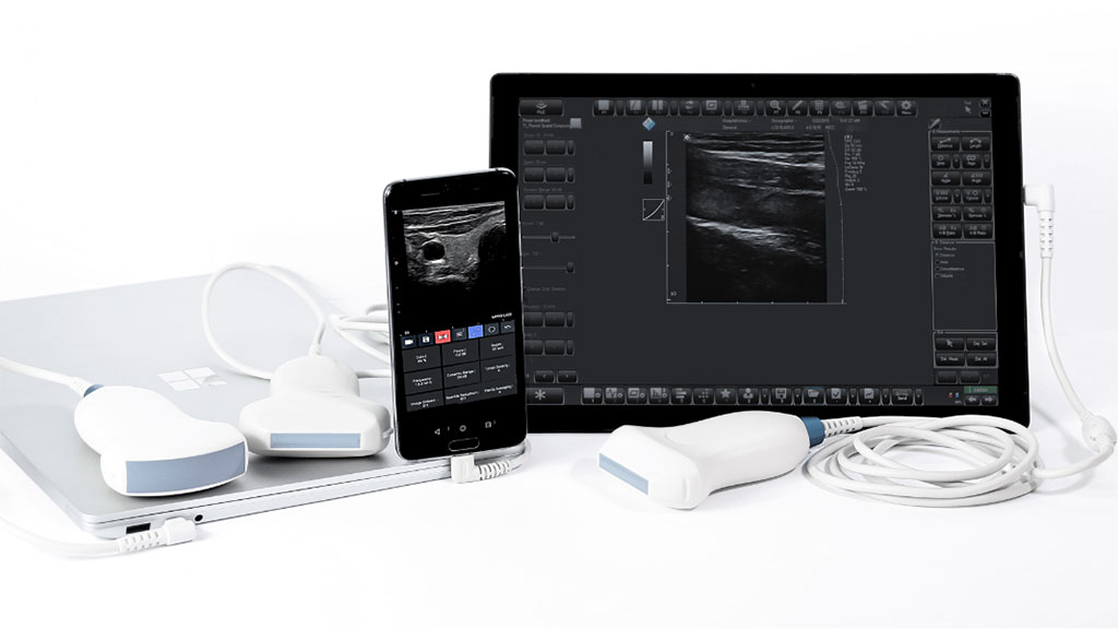 Image: MicrUs Pro Hand held USB Ultrasound (Photo courtesy of TELEMED Medical Systems)