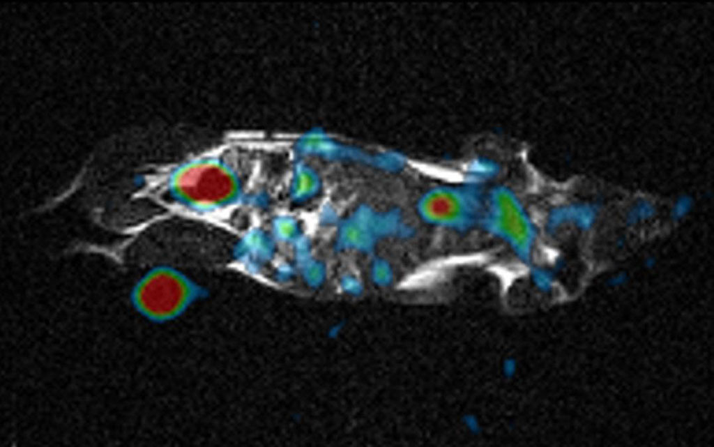 Image: MRI Machines Retrofitted With Radio-Frequency Repeater May Lead to Enhanced Clinical Imaging at Low Cost (Photo courtesy of University of Tsukuba) Image: MRI Machines Retrofitted With Radio-Frequency Repeater May Lead to Enhanced Clinical Imaging at Low Cost (Photo courtesy of University of Tsukuba)