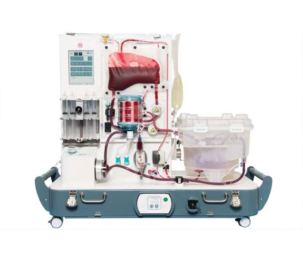 Image: The metra normothermic machine perfusion system (Photo courtesy of OrganOx)