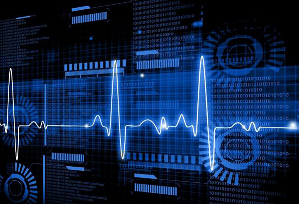 Image: AI can help identify mortality risk in cardiac surgery patients (Photo courtesy of Shutterstock)