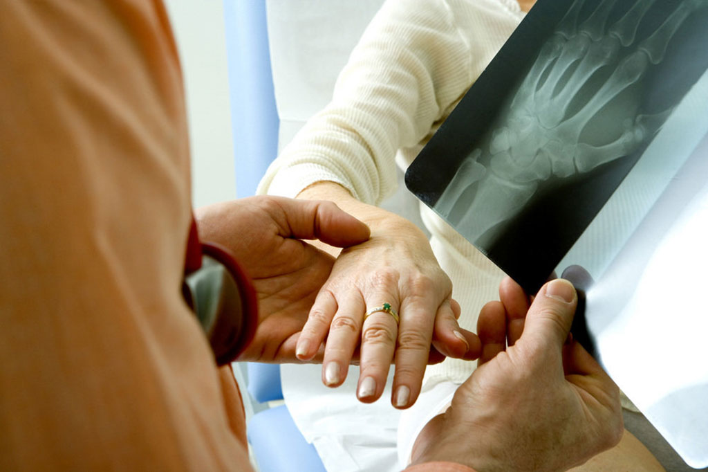 Image: Plaster casts offer good resolution of wrist fractures (Photo courtesy of Getty Images)