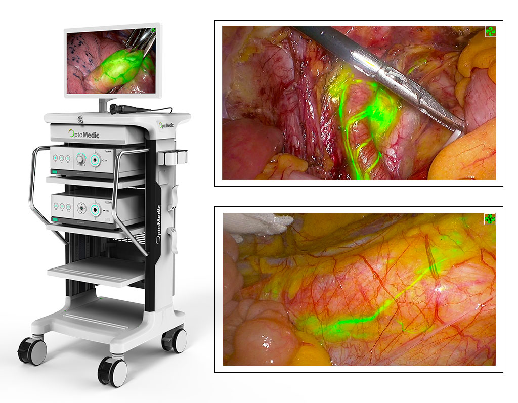 Image: 2100 HD FloNavi Fluorescence Endoscopic Imaging System (Photo courtesy of OptoMedic Technologies, Inc.)