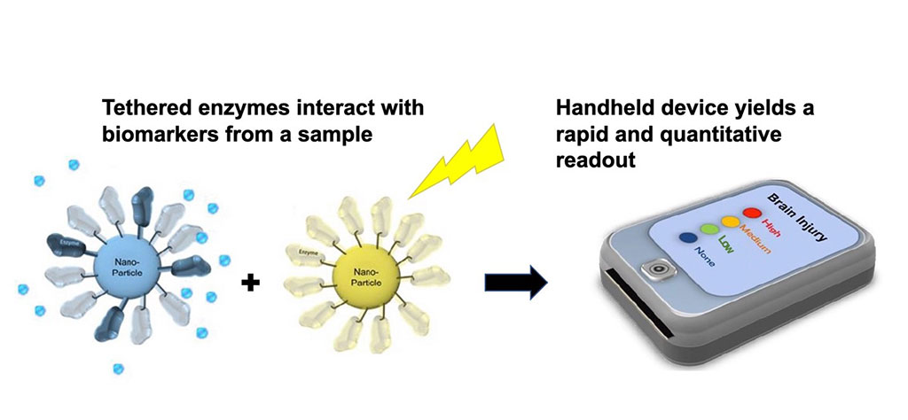 Image: New rapid diagnostic test to detect signs of a stroke or other brain injury (Photo courtesy of TETDiagnostics)