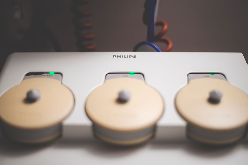 Image: Burst wave lithotripsy promises a new approach for noninvasive treatment of kidney stones (Photo courtesy of Unsplash) Image: Burst wave lithotripsy promises a new approach for noninvasive treatment of kidney stones (Photo courtesy of Unsplash)