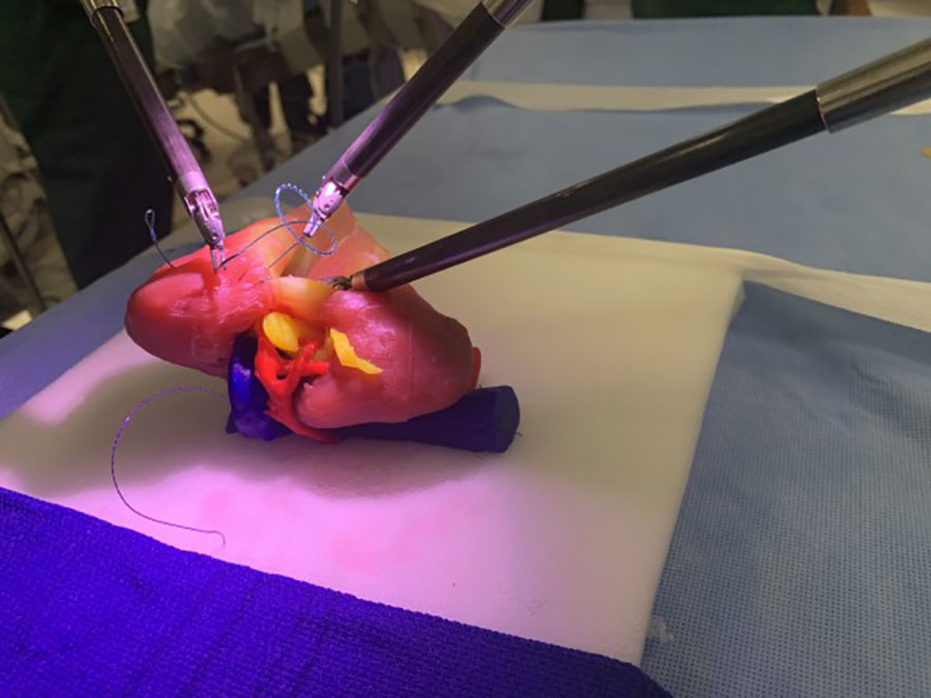 Image: 3D kidney models made from pliable materials to replicate look and feel of actual human tissue (Photo courtesy of Lazarus 3D)