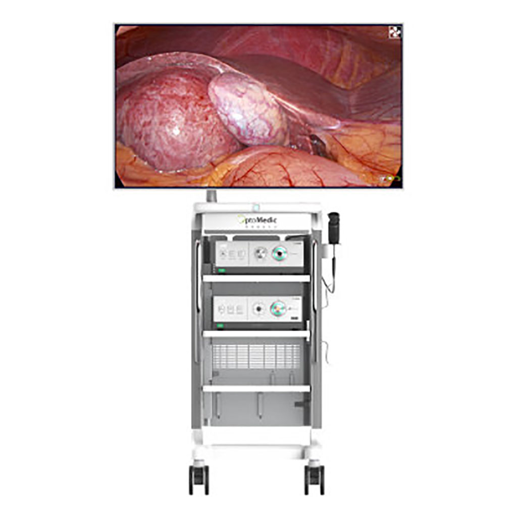 Image: OptoMedic 104K ultra HD white light endoscopic imaging system uses advanced technology to assist surgeons (Photo courtesy of OptoMedic)